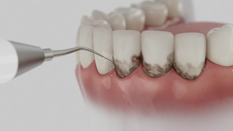 Reliable Teeth Whitening contractor in Morton County County, ND by Dentist Open Now